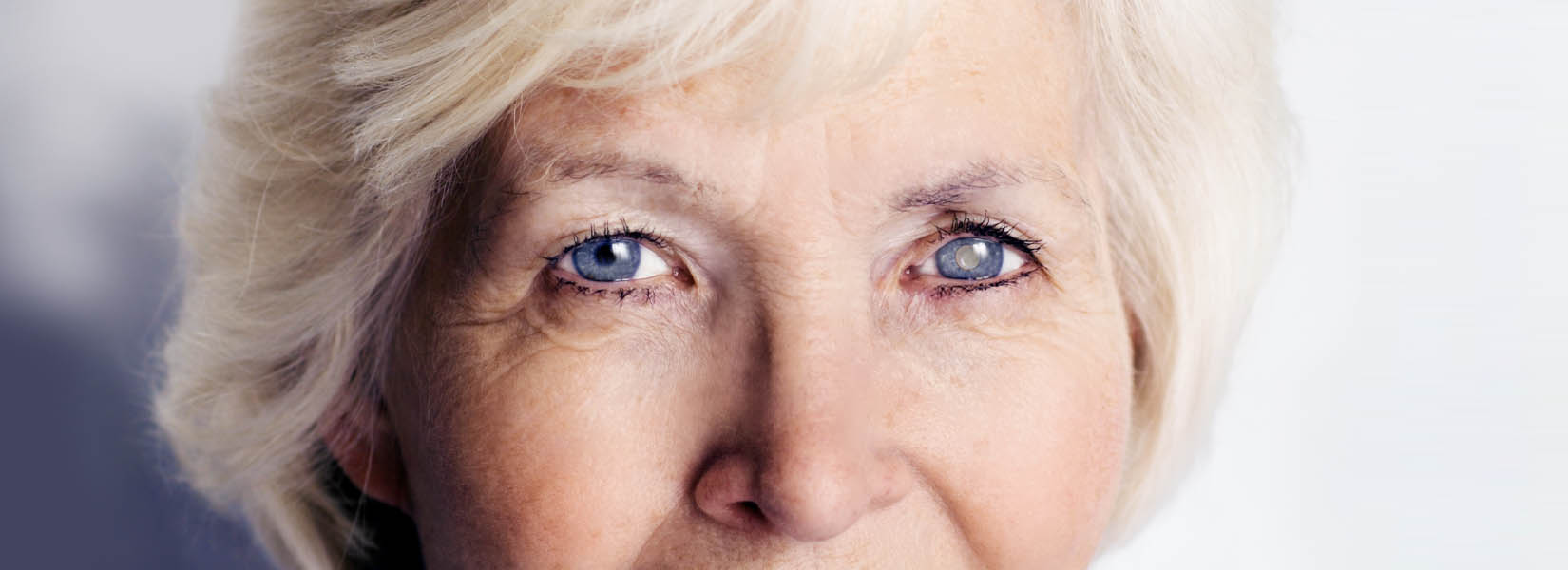 Cataract Surgery in Toledo