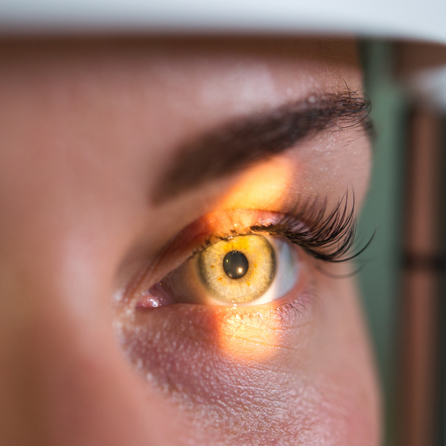 Vision Therapy in Toledo